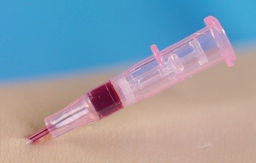 CATH IV AUTOGUARD BLOOD COLL 20G X 1" - 50/BX