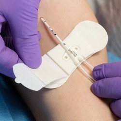 GRIP_LOK CS for NAVALYST XCELA® - 50/Bx